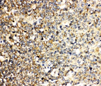 IL3 Antibody (aa119-140)
