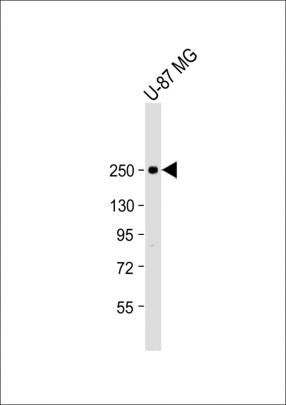 SCN1A / Nav1.1 Antibody (Internal)