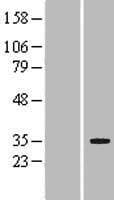 Human LRP5L Protein (Over-Expression Lysate Myc-DDK (Flag))
