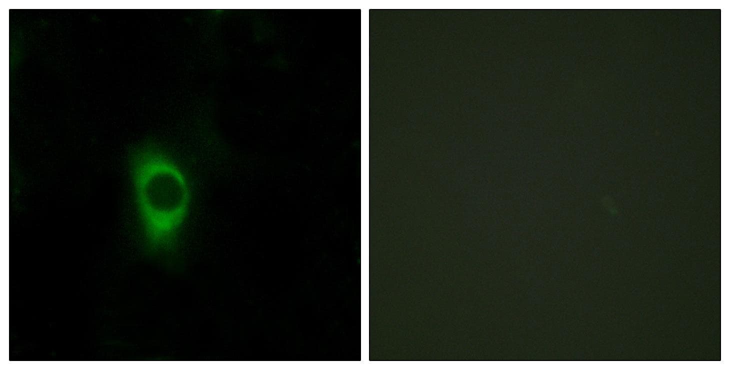 HTR2B / 5-HT2B Receptor Antibody