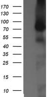 Monoclonal Mouse anti-Human NEK11 Antibody (clone OTI5D9, IHC, IF, WB)