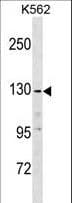 Polyclonal Rabbit anti-Human EGF Antibody (aa940-967, WB)