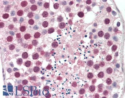 IHC-plus™ Monoclonal Mouse anti-Human RACGAP1 / MGCRACGAP Antibody (clone 1G6, IHC, WB)