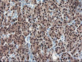 PGM3 Antibody (clone OTI1B8)