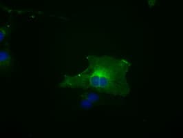 Monoclonal Mouse anti-Human BUB1B / BubR1 Antibody (clone OTI6E5, IHC, IF, WB)