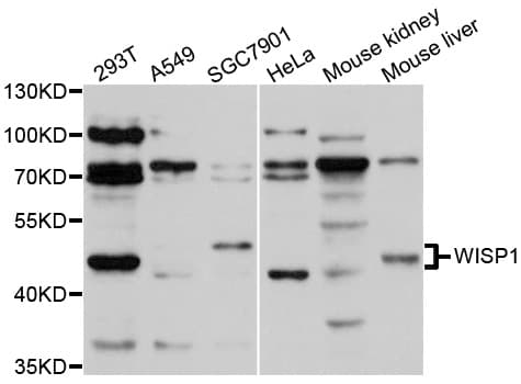 CCN4 / WISP1 Antibody