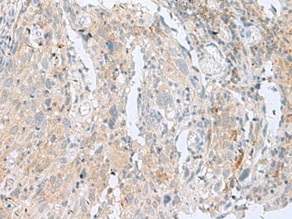 SLC26A3 / DRA Antibody