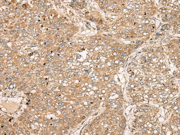 TDGF1 / CRIPTO Antibody