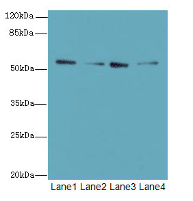 Polyclonal Rabbit anti-Human ERO1LB Antibody (IHC, WB)