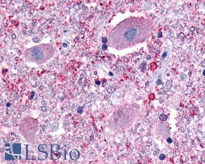PathPlus™ NPFFR1 / GPR147 Antibody (C-Terminus)