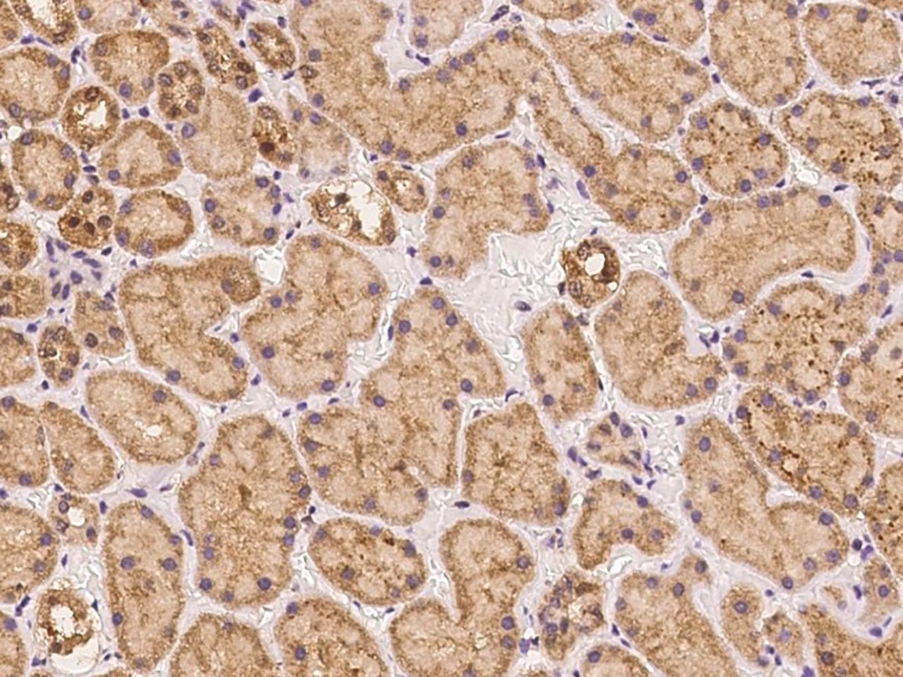 TRMT61B Antibody