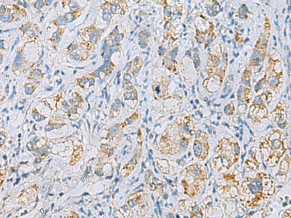 PLA2G15 / ACS Antibody