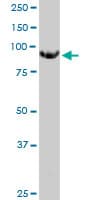 GNT-V / MGAT5 Antibody (clone 3E9)