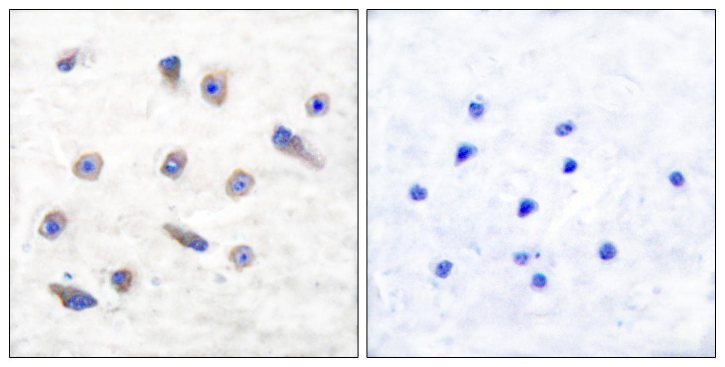 TH / Tyrosine Hydroxylase Antibody (phospho-Ser31)