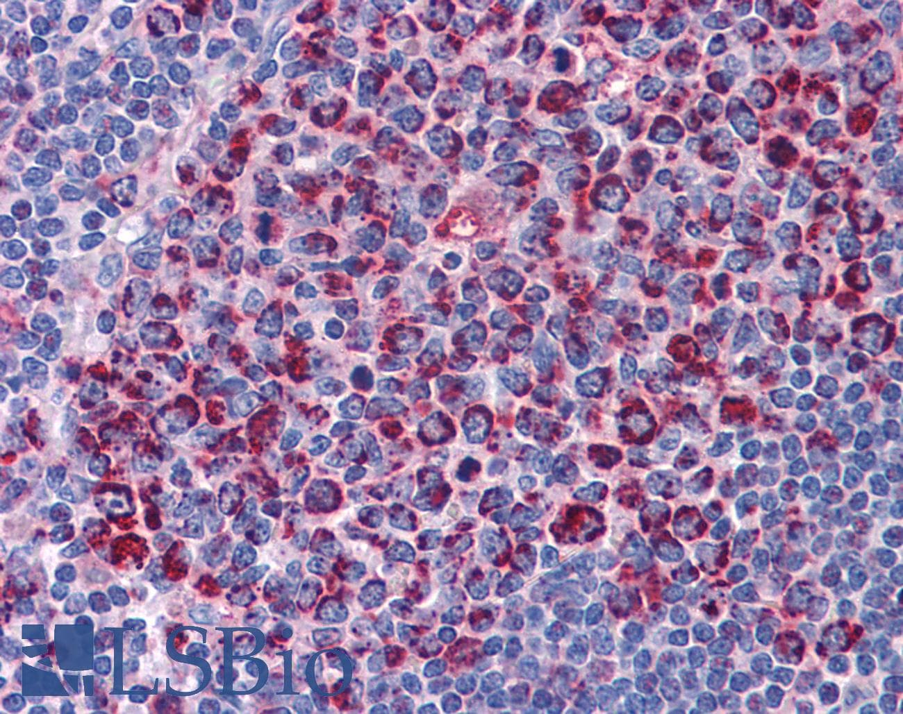 IHC-plus™ Monoclonal Mouse anti-Human SH3BP5 / SAB Antibody (clone 2B3, IHC, IF, WB)