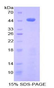 Pig CXCL7 / PPBP Protein (Recombinant His-GST)