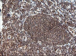 TRMT2A Antibody (clone OTI1H8, Carrier-free)