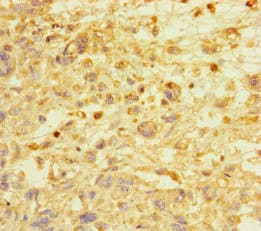 Polyclonal Rabbit anti-Human E2F1 Antibody (IHC, WB)