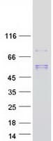 Human SCPEP1 / RISC Protein (Recombinant Myc-DDK (Flag))