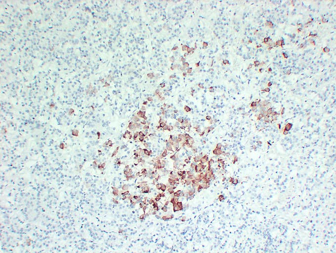 TSHB / TSH-Beta Antibody (clone ABT-TSH)