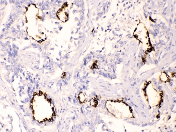 Polyclonal Rabbit anti-Human AGR2 Antibody (IHC, WB)