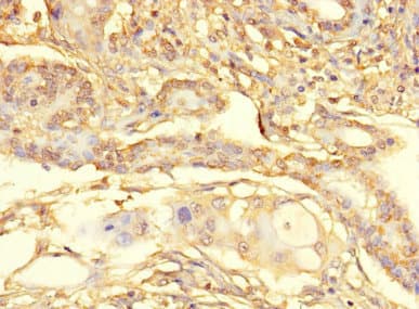 Polyclonal Rabbit anti-Human C13orf39 Antibody (IHC, IF)