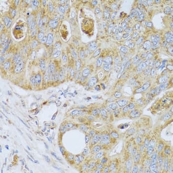 PSG1 / CD66f Antibody