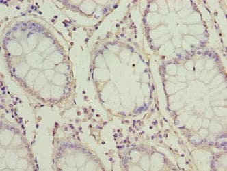 ZNF767 Antibody