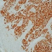 PathPlus™ Monoclonal Mouse anti-Human HSPB1 / HSP27 Antibody (IHC, WB)