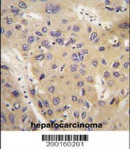 APG12 / ATG12 Antibody