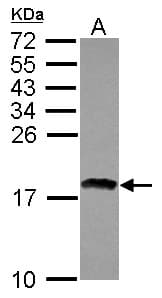 Polyclonal Rabbit anti-Human RAXL1 / RAX2 Antibody (WB)