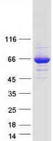 Human TTC39C Protein (Recombinant Myc-DDK (Flag))
