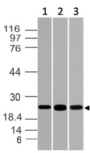 BRN2 / POU3F2 Antibody