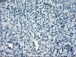 Monoclonal Mouse anti-Human TMEM100 Antibody (clone OTI10G3, IHC, IF, WB)