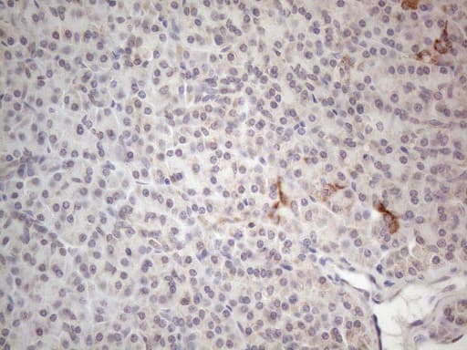 Monoclonal Mouse anti-Human RORB / ROR Beta Antibody (clone OTI1G1, aa1-260, IHC, WB)