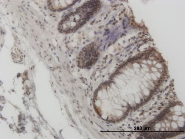 KAT2A / GCN5 Antibody (clone 3F8)