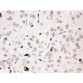 CP / Ceruloplasmin Antibody (aa20-258)