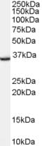 IHC-plus™ TSPO / PBR Antibody (aa156-169)