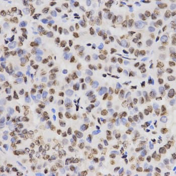 Histone H3 Antibody (Trimethyl-Lys27)
