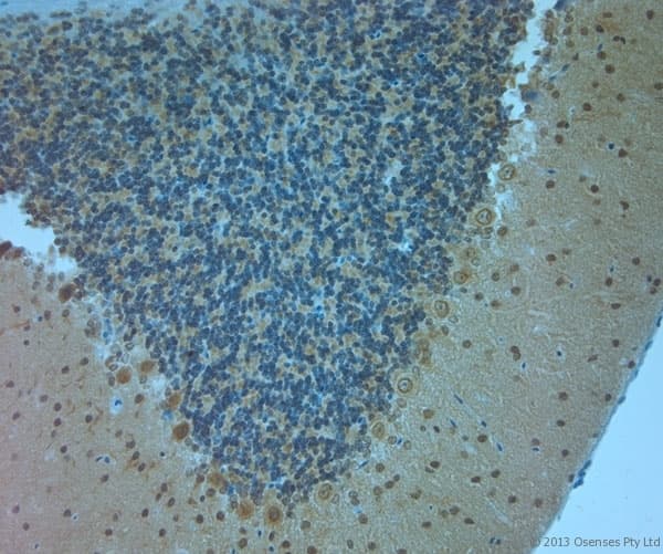 Polyclonal Rabbit anti-Human CLVS1 Antibody (aa300-354, IHC, WB)