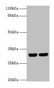 Polyclonal Rabbit anti-Human HLA-DRB1 Antibody (aa30-266, WB)