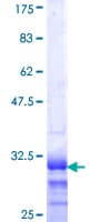 Human HOXB4 Protein (Recombinant GST, N-terminus)