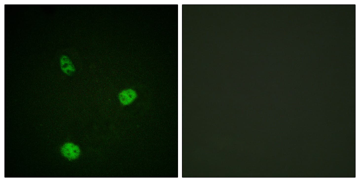 Polyclonal Rabbit anti-Human MITF Antibody (aa151-200, IHC, IF, WB)