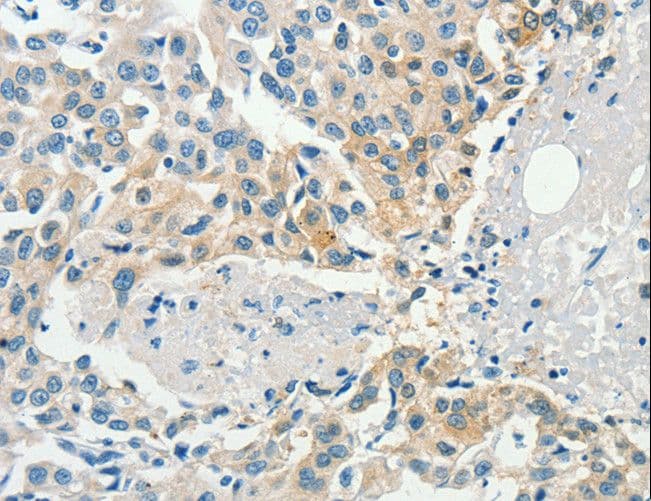 DGKB / DGK Beta Antibody