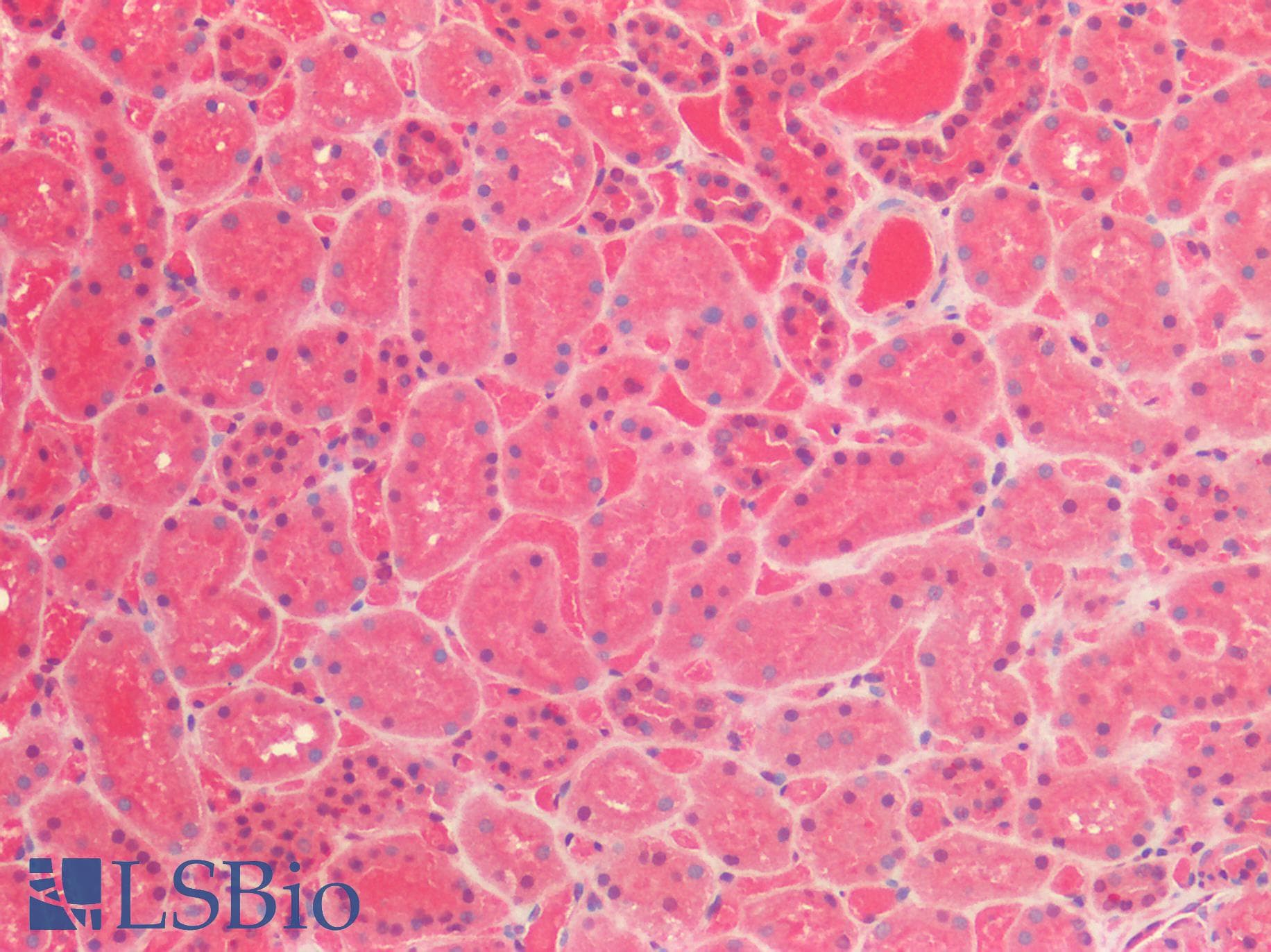 IHC-plus™ Polyclonal Rabbit anti-Human HDAC6 Antibody (IHC)