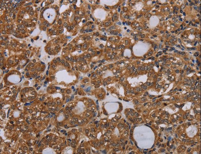 Polyclonal Rabbit anti-Human PARP8 Antibody (IHC)