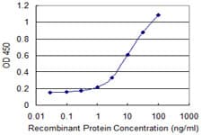 CRYBA4 Antibody (clone 1D7)
