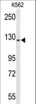 TRERF1 Antibody (aa1136-1164)