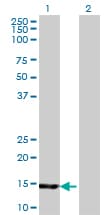 HR6B / UBE2B Antibody (clone 4C3)