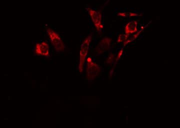LGALS8 / Galectin 8 Antibody